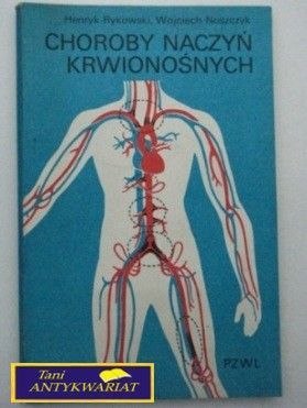 CHOROBY NACZYŃ KRWIONOŚNYCH