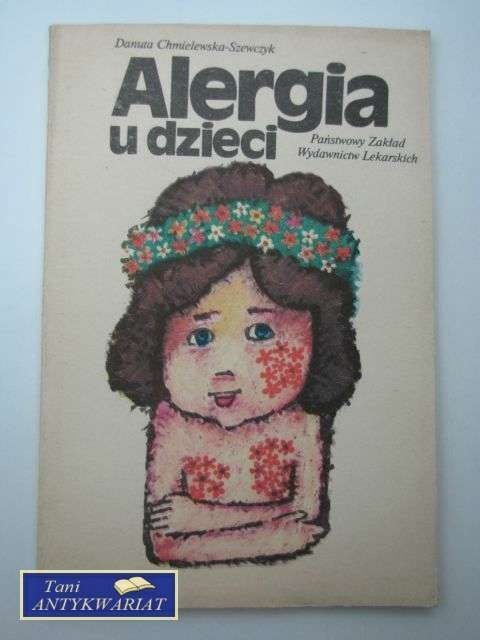 ALERGIA U DZIECI
