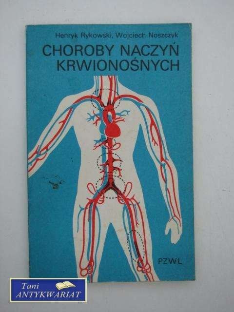 CHOROBY NACZYŃ KRWIONOŚNYCH