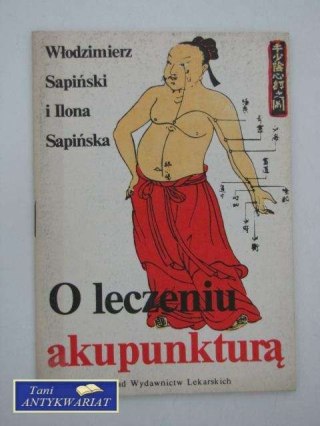 O LECZENIU AKUPUNKTURĄ