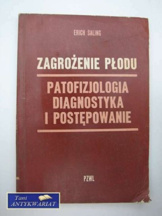 ZAGROŻENIE PŁODU